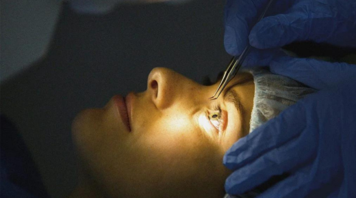 Before and After LASIK Eye Surgery - What to Expect